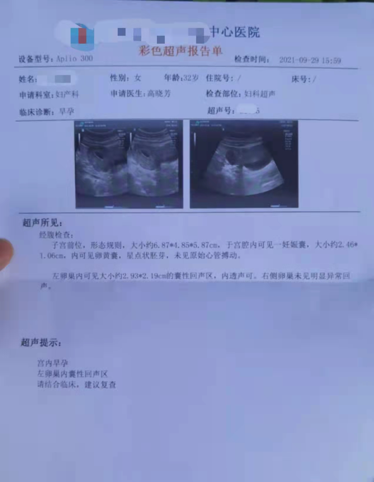 温州妇产医院孕检